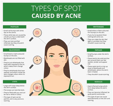 causes of spots in adults.